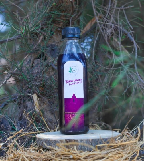 chrome dandruf2 (1 of 1) (1)